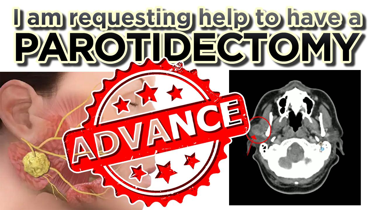 Progress of the "Parotidectomy Fundraising Campaign