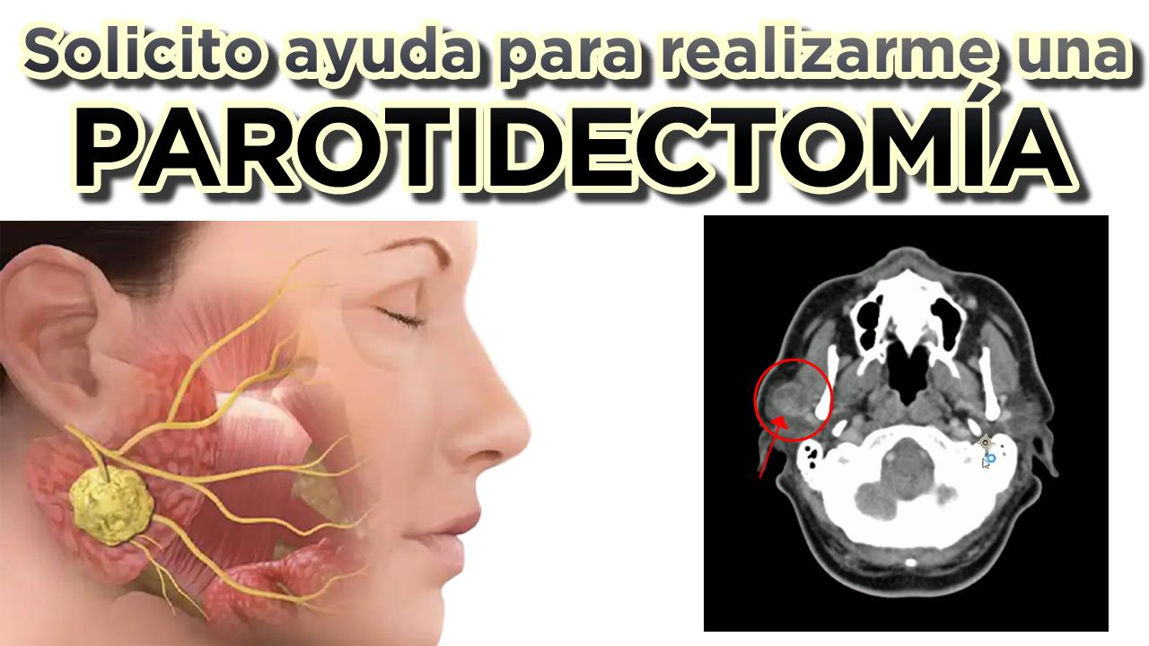 [La Campaña](https://free2z.cash/robmarn/zpage/campana-de-recaudacion-para-realizarme-una-parotidectomia)