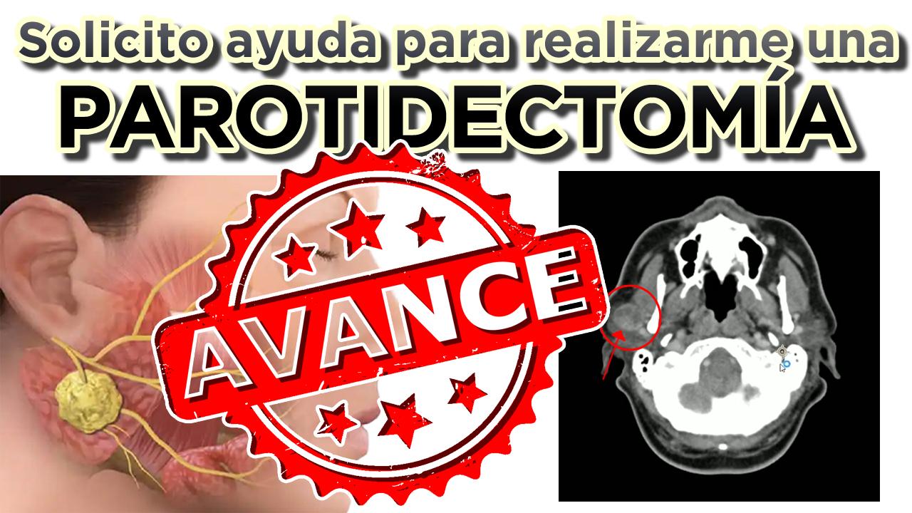 Avances de "Campaña de Recaudación para realizarme una Parotidectomía